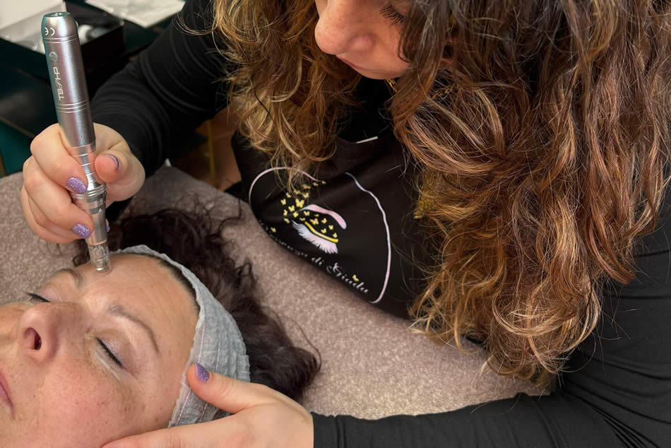 MICRONEEDLING oleggio